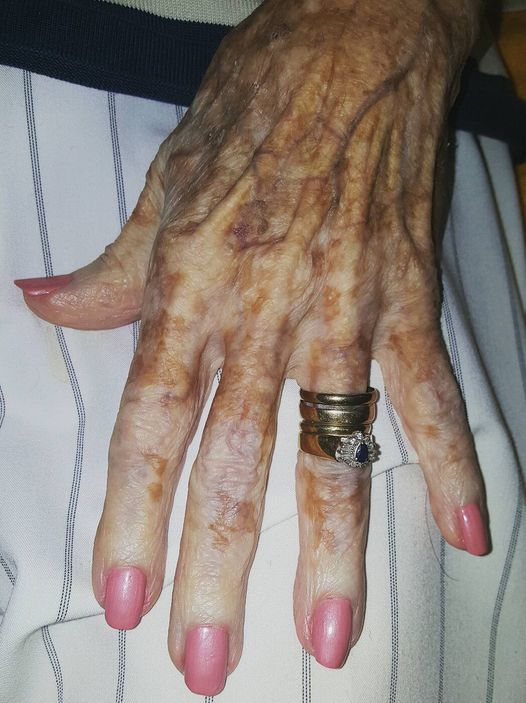 A nurse snaps a photo of an elderly woman’s hand, only to notice a detail in the picture that causes a stir on the internet.