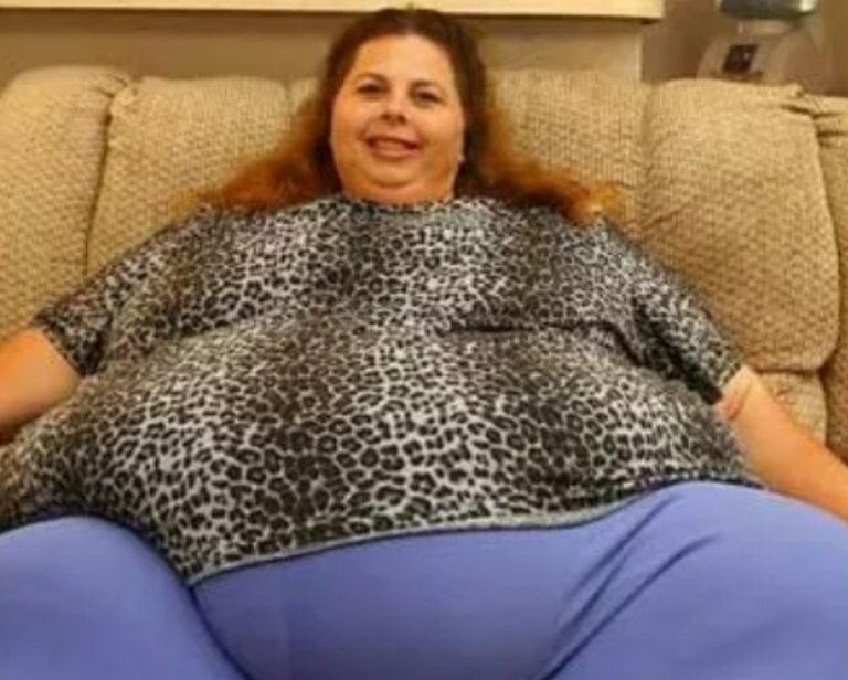 This woman lost 518 pounds at 57 and..