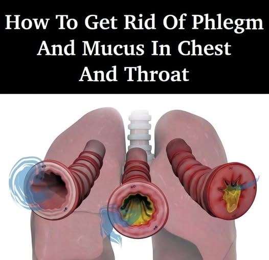 How To Get Rid Of Phlegm And Mucus In Your Throat And Chest On Your Own