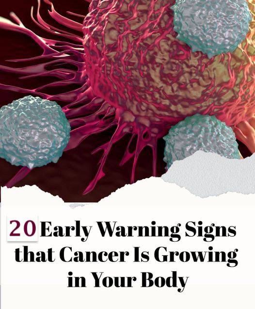 If You Spot These 20+ Signs Cancer May Be Growing In Your Body