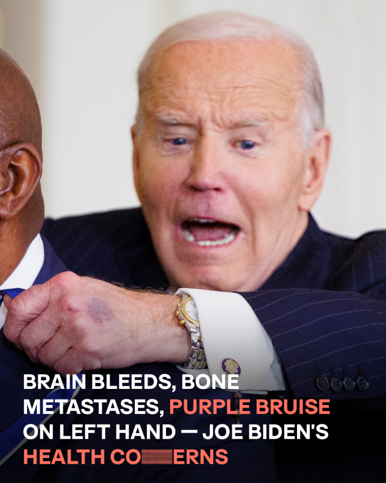 Brain Bleeds and Ca.cer That Spread to His Bones
