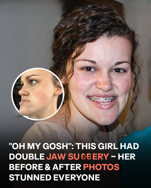 This Young Woman, Who ‘Hated Looking in the Mirror,’