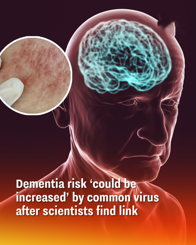 Dementia risk ‘could be increased’ by