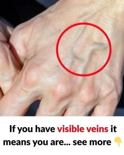 Why are your veins suddenly bulging and visible?