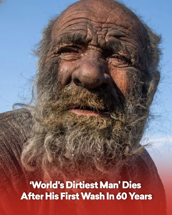 ‘World’s Dirtiest Man’ Dies After His First Wash In 60 Years