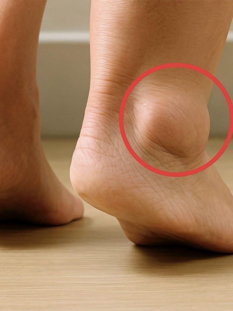 Swollen Legs..