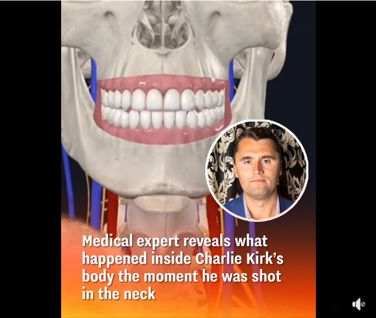 Charlie Kirk Shooting: What Happened in His Body