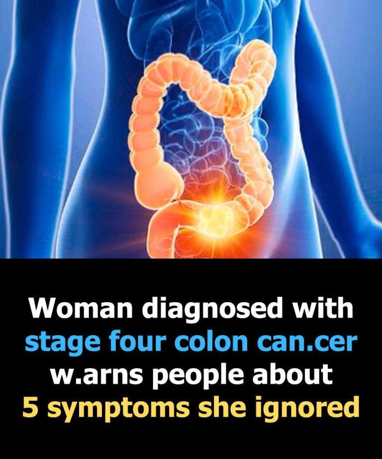 How Your Bowel Movements Reveal Clues About Colon Cancer
