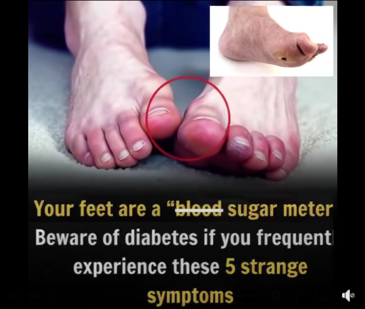 Here are five unusual foot symptoms