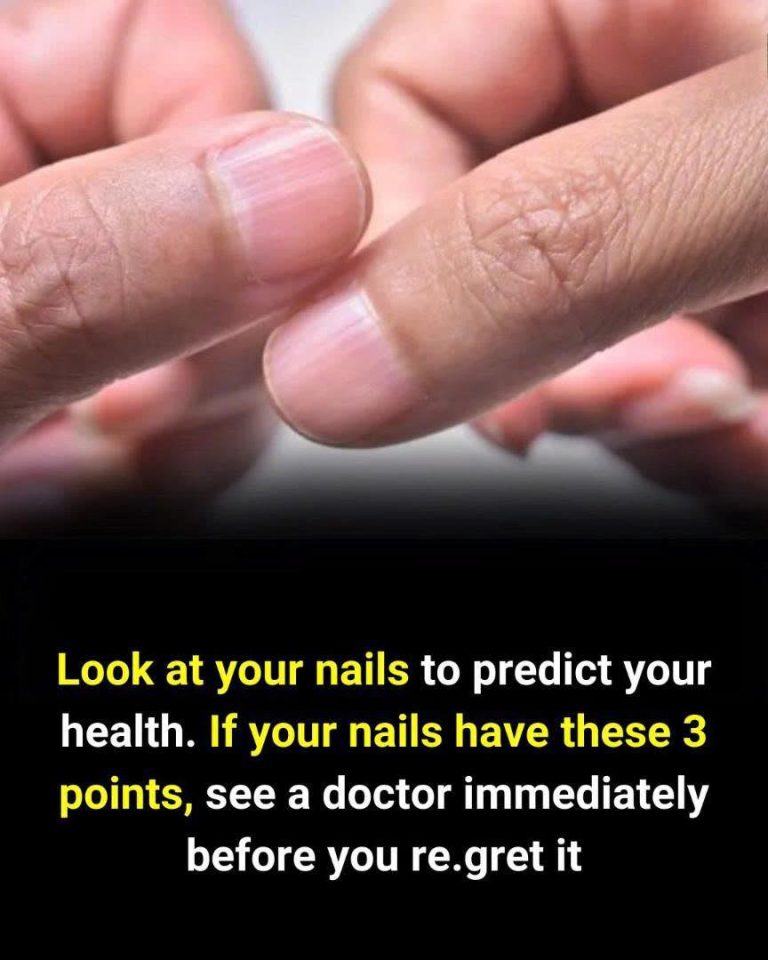 Observe your nails to detect health issues