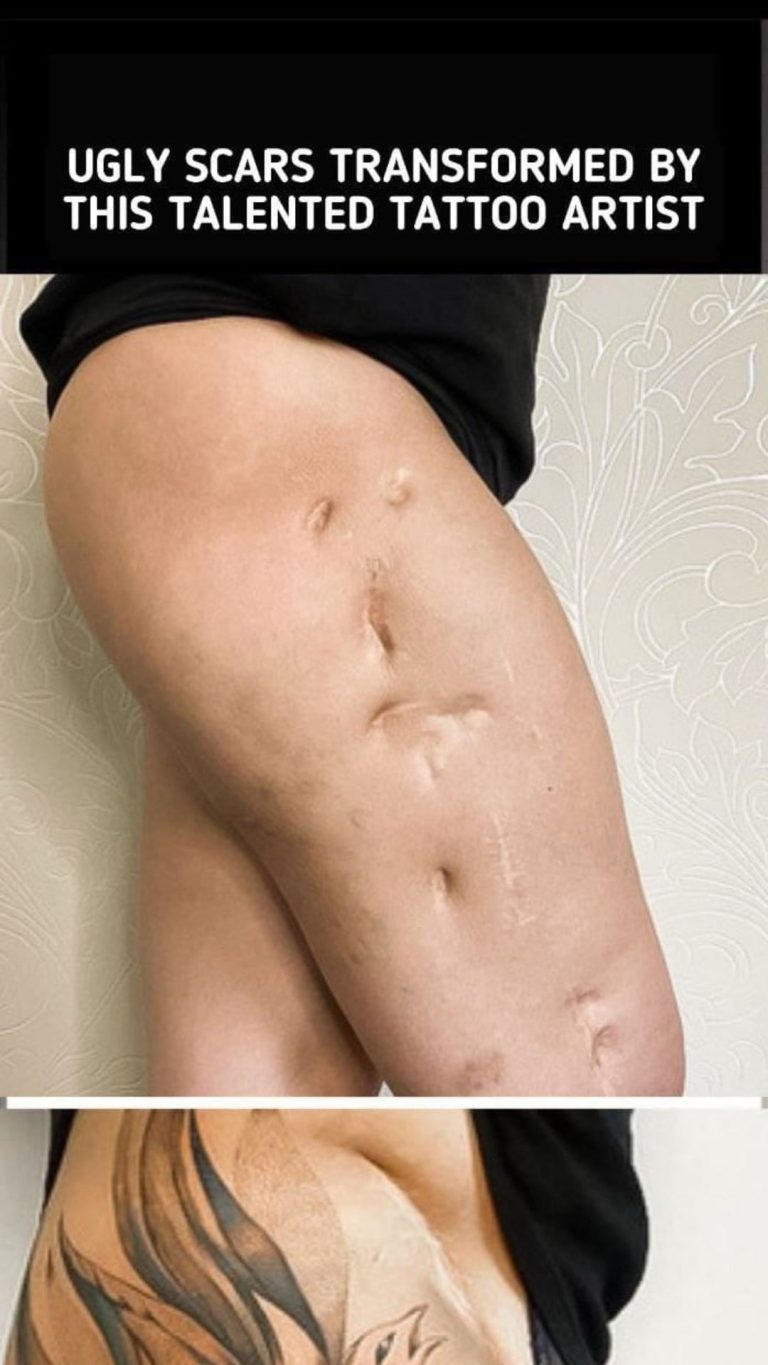 Tattoos that help turn your scars into something beautiful