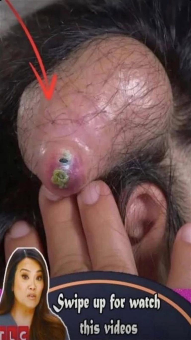 8 ALARMING SKIN SIGNS YOU