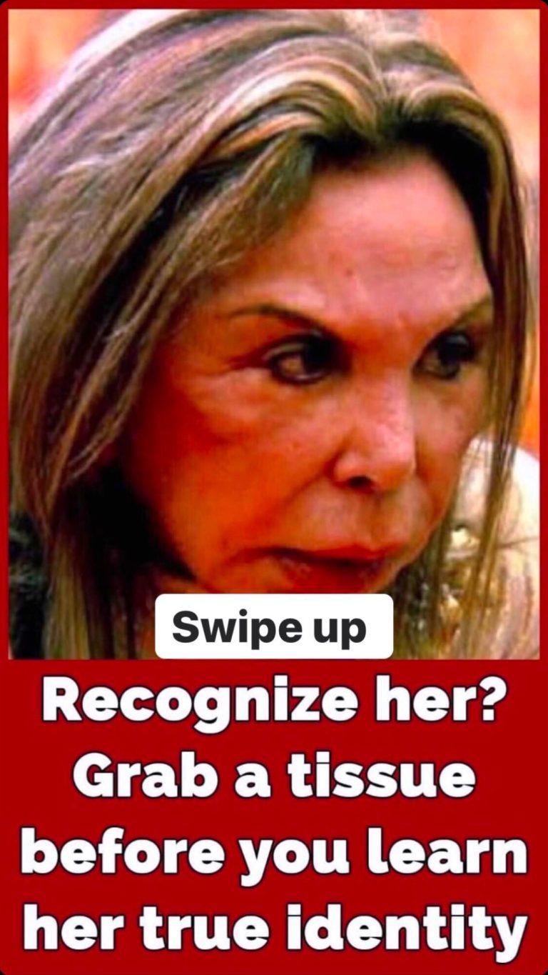 Elsa Patton had a shocking plastic surgery journey: Inside the procedures