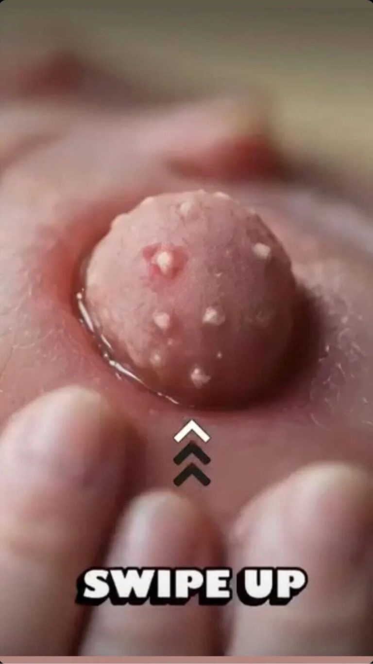 ST. Seven Items That Block Your Pores And Lead To Acne