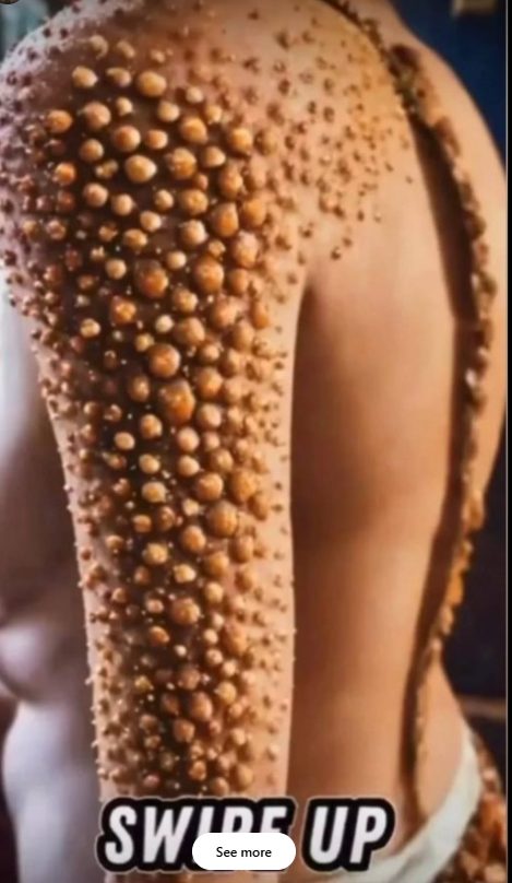 ST.10 Signs Showing Something Is Wrong in Your Body