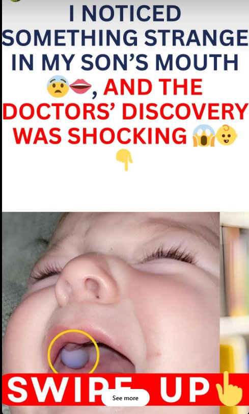 ST. I noticed something strange in my son’s mouth and rushed him to the doctor. What the doctors discovered in the little child’s mouth shocked us all.
