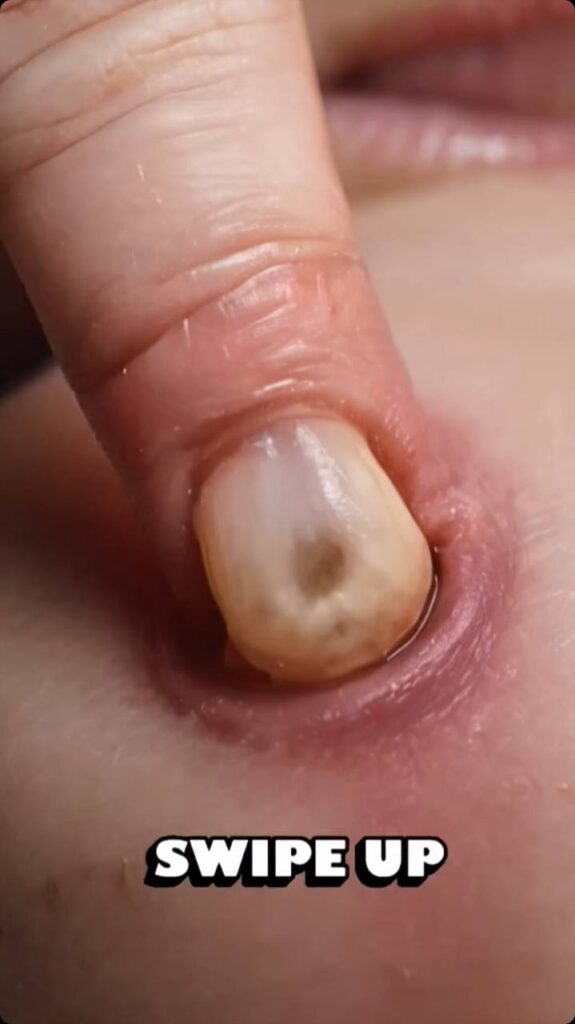 ST. Body Acne: 10 Tips To Get Rid Of Them