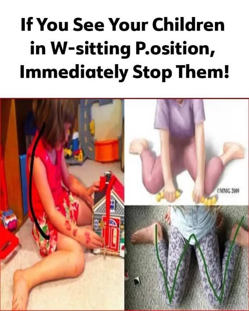 If You See Your C.hildren in W-sitting P.osition, Immediately Stop Them!