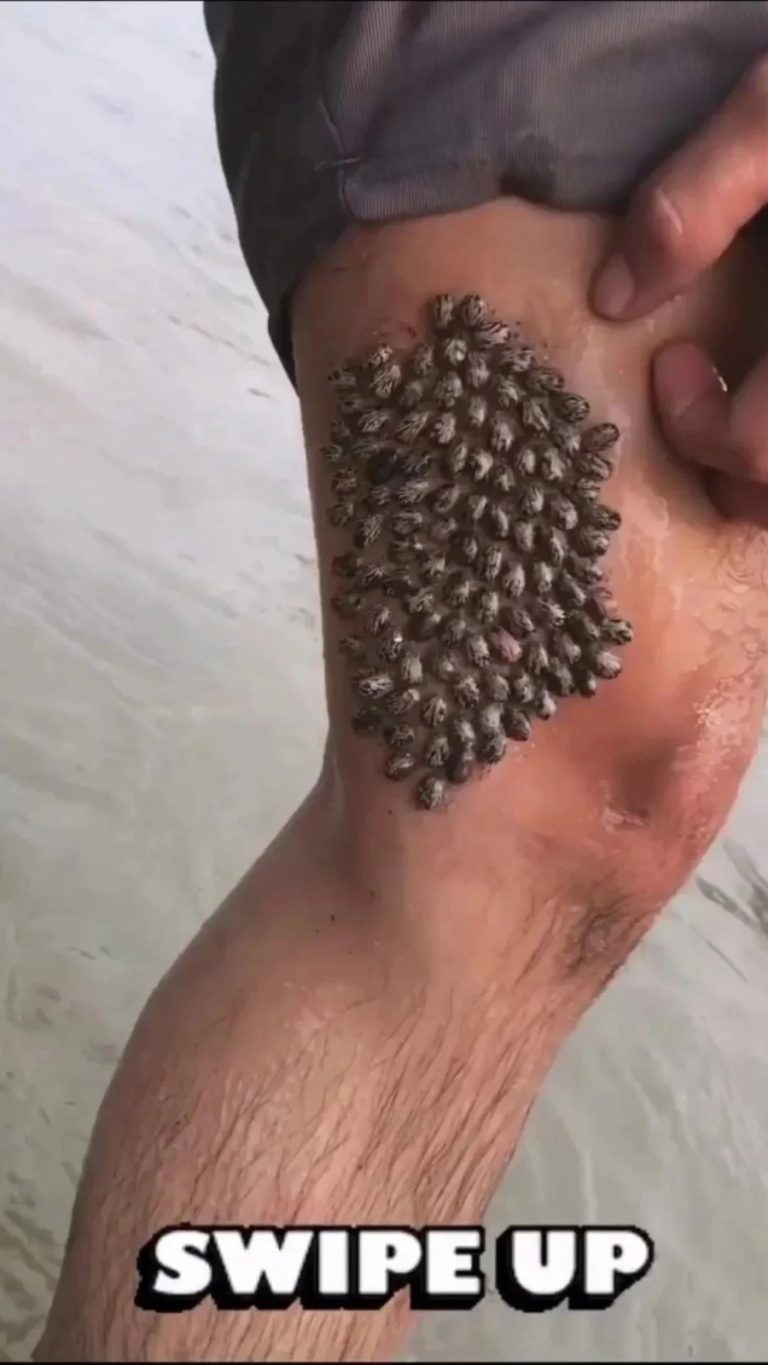 WHY SKIN CHANGES LIKE REDNESS OR ITCHING ON THE LEGS CAN OCCUR