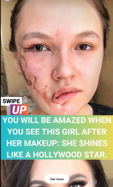 From Pain to Radiance: How Goar Avetisyan Helped a Young Woman Reclaim Her Beauty