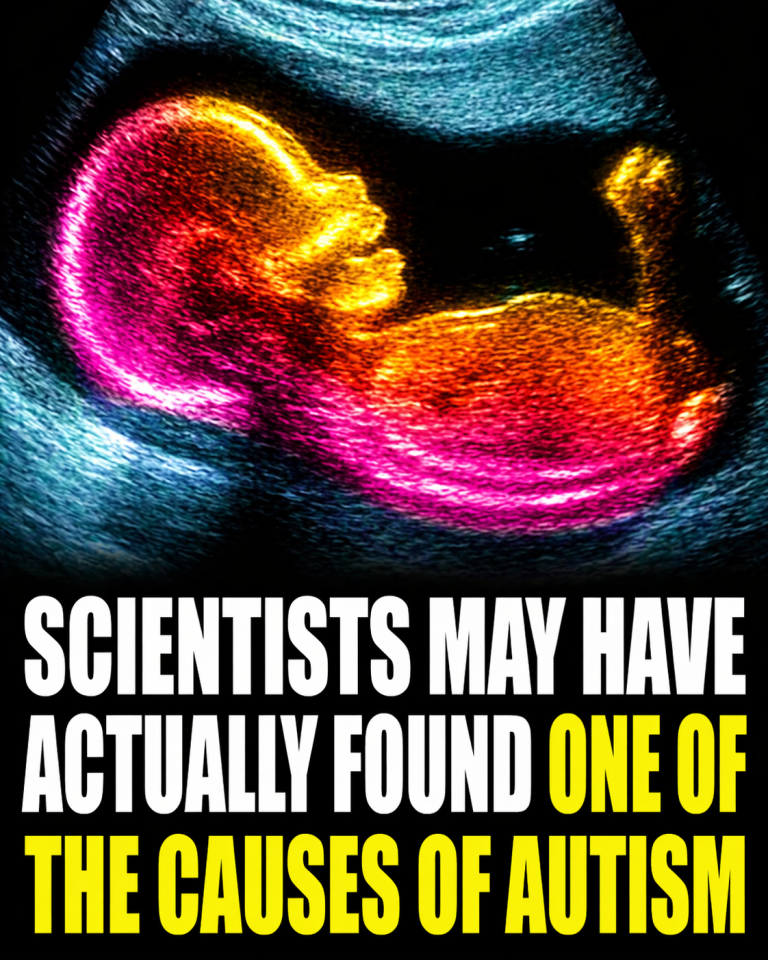 Study identifies possible connection to autism development