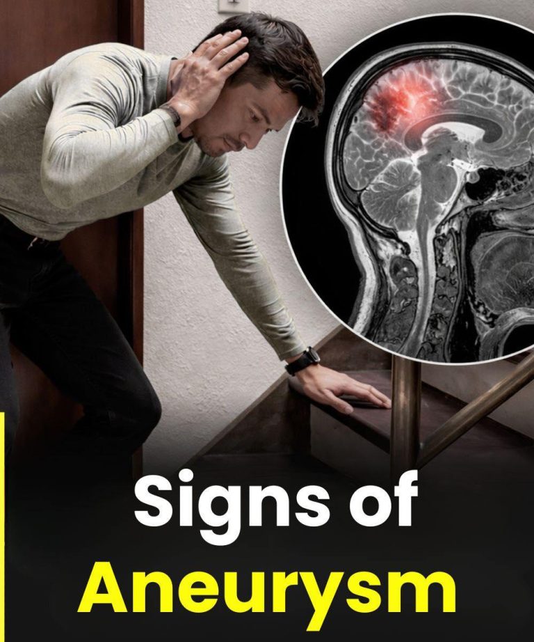 War:ning Signs of Aneurysm in Men: What You Should Never Ignore