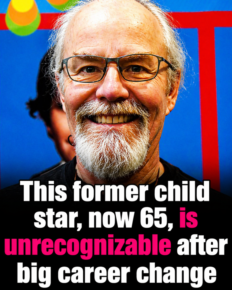 Former Child Star at 65 Surprises Fans With Transformation