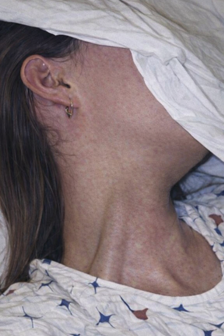 Young woman was hospitalized after