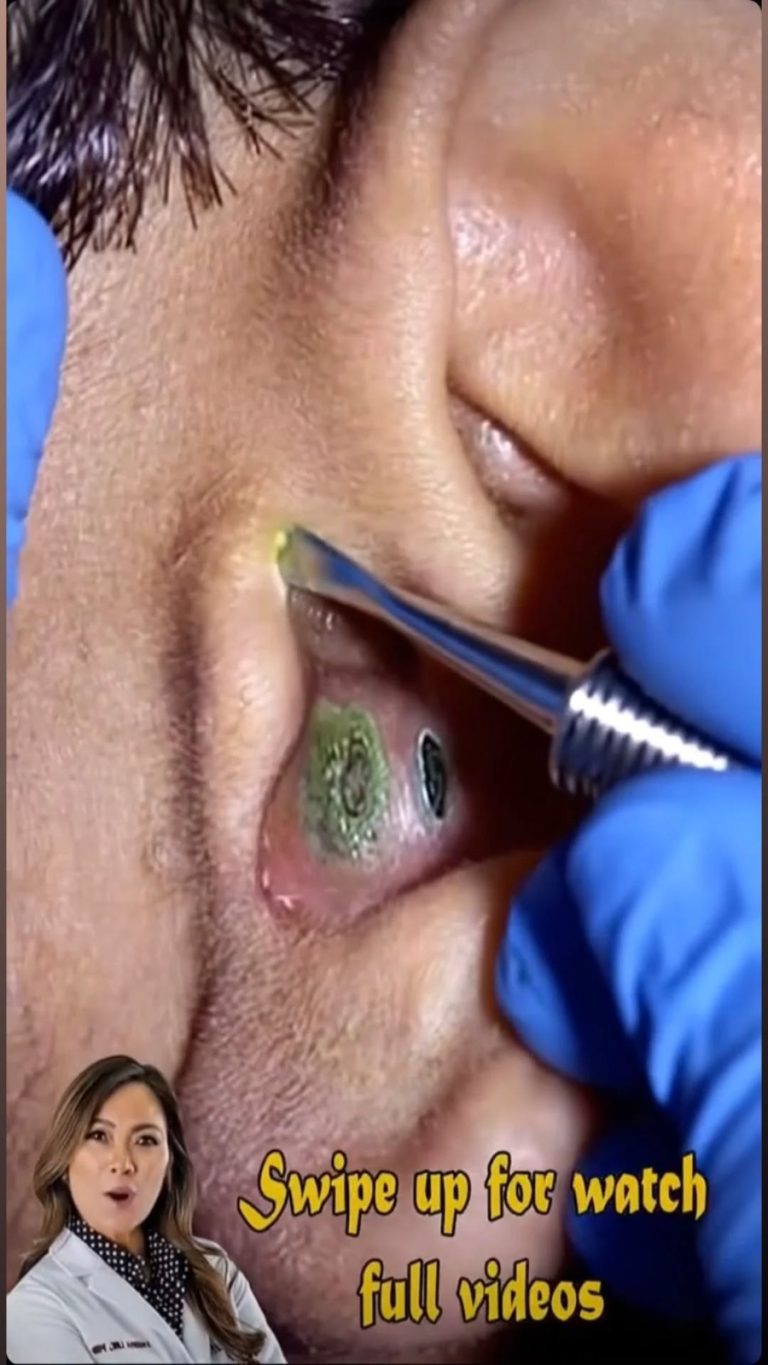 10 Signs Showing Something Is Wrong in Your Body