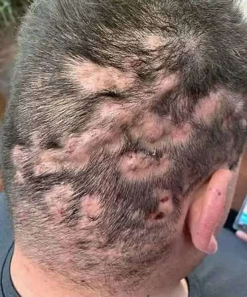 These are the first symptoms of cr…