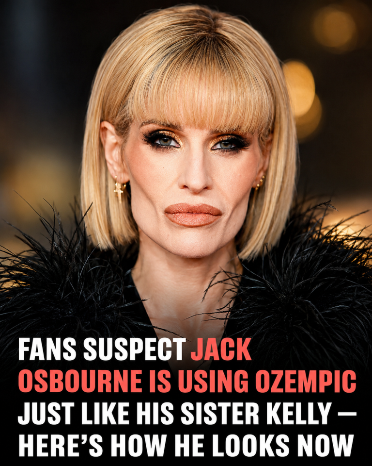 Jack Osbourne’s New Look Sparks Online Reactions