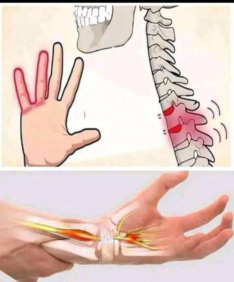 If your HANDS fall