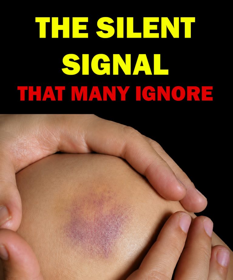 Early Leukemia Signs That Should Not Be Ignored