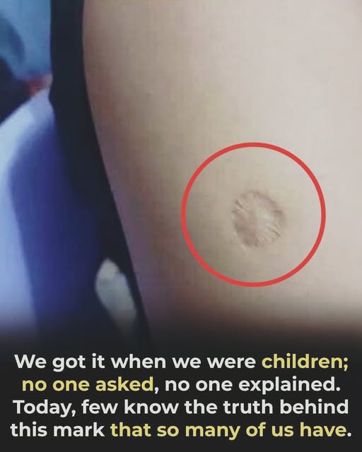 What the Small Round Scar on Your Arm May Mean