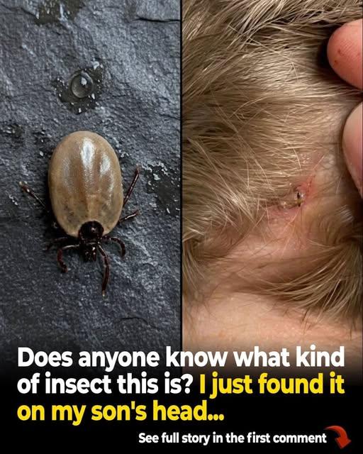 What to Do If You Find Bugs in Your Child’s Hair
