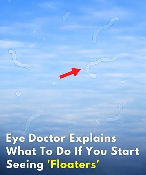 Eye floaters: what they are and what to do if you notice them, according to an eye doctor
