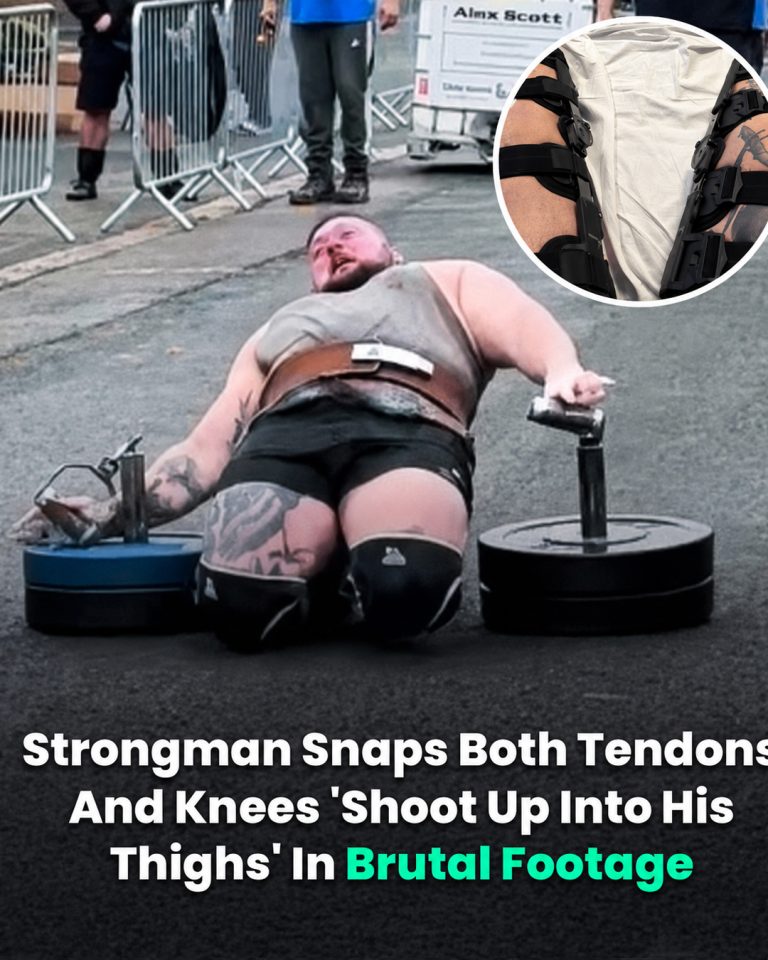 Strongman Suffers Serious Injury During Competition Final