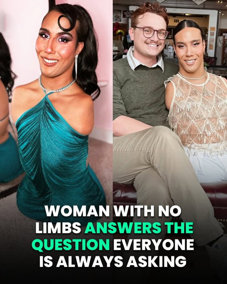 Woman With No Limbs Answers The Question Everyone Is Always Asking