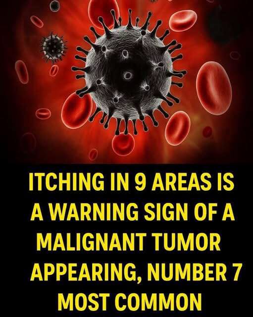 Itching in 9 Areas