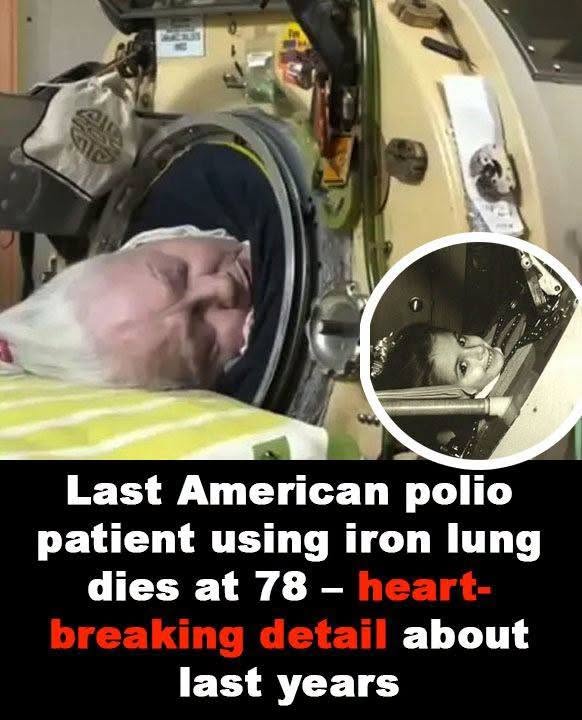Last American polio